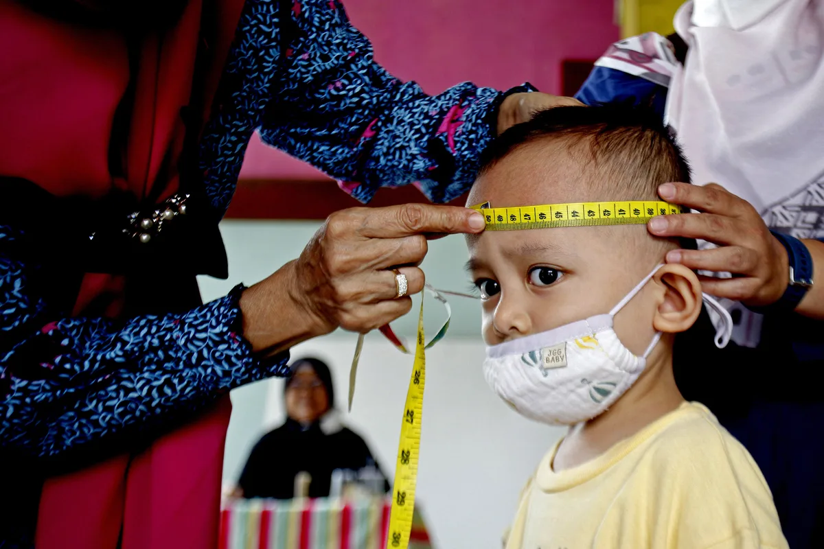 pencegahan stunting banyuwangi, stunting banyuwangi,: Pertanyaan yang Sering Muncul di Masyarakat